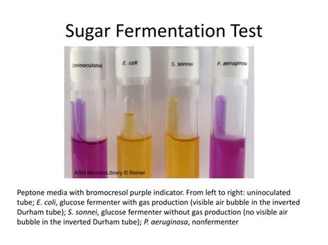 e coli fermentation test